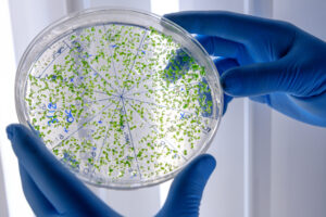Principles and Quality Control in Microbiological Routine