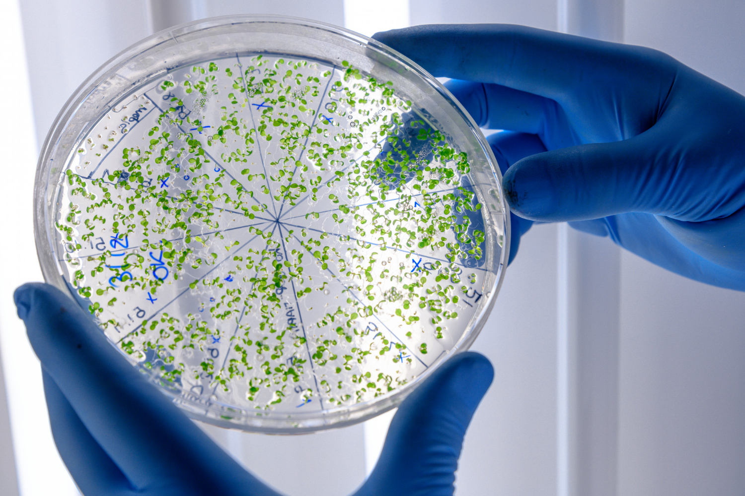 Principles and Quality Control in Microbiological Routine