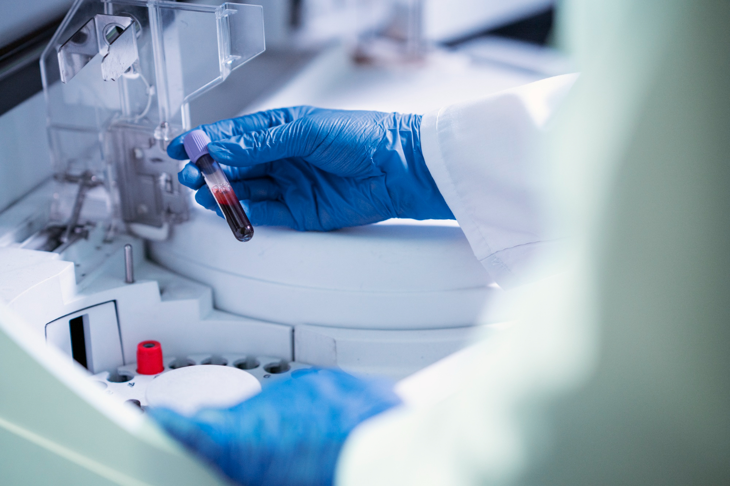 Risk Assessment in the Clinical Laboratory -from theory to practice